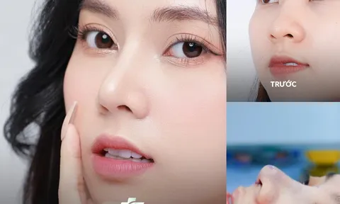 TOP 11 bệnh viện thẩm mỹ Hà Nội bác sĩ tay nghề giỏi nhất